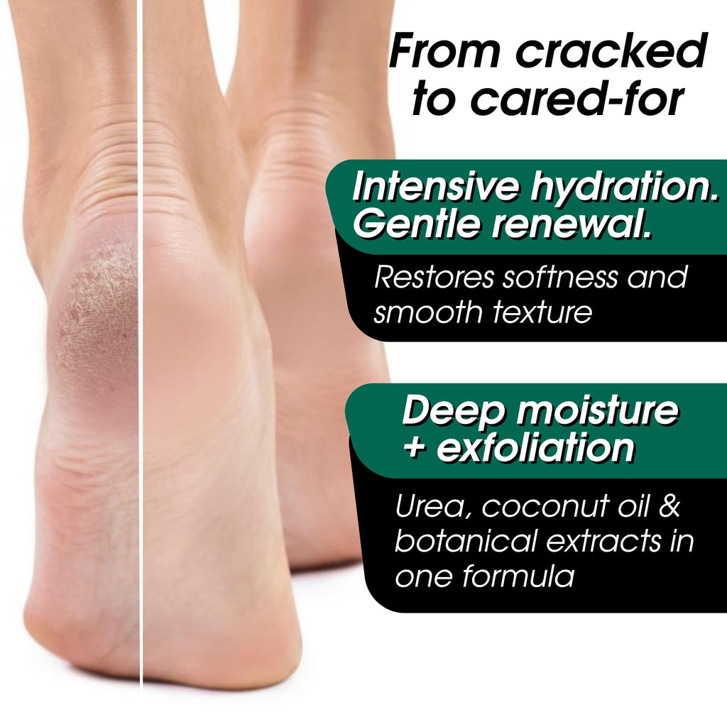 Urea Cream 40 Percent for Feet Maximum Strength